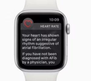 Apple Watch SE 2'de EKG Sensörü Var mı?
